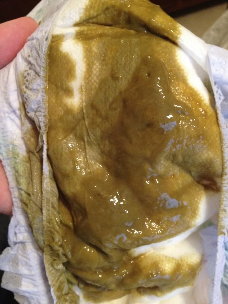 Blood in stool with Alimentum???!!!! | BabyCenter